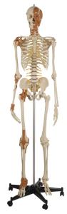 Rudiger® Total Skeleton