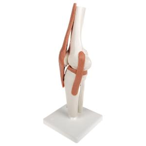 Functional Knee Joint