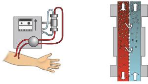 Science Take-Out® Kidney Dialysis