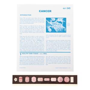 Cancer Microslide