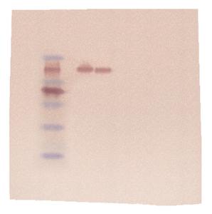 Western Blot Analysis Kit, Edvotek