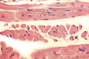 Muscle (Mammalian), Striated Slide