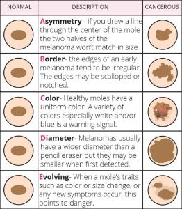 Science Take-Out® A Case Of Skin Cancer