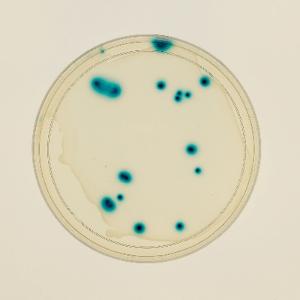 Ward's® Transduction of E.coli Lab Activity