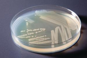 Ward's® AP Biology Investigation 8: Genetics and Information Transfer: Transformation