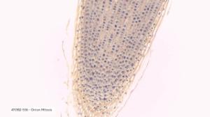 470182-536 - Iron hematoxylin and Orange G stain (LS)