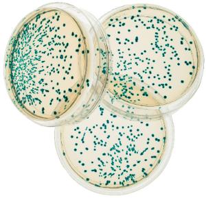 Transformation of <i>Escherichia coli</i> Lab, Edvotek