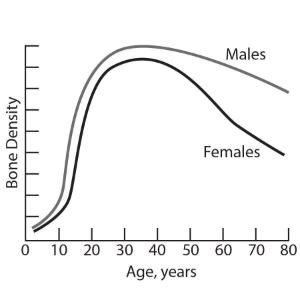 Science Take-Out® Brittle Bones: A Density Problem