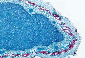 Root Nodules, Legume Bacteria Slide