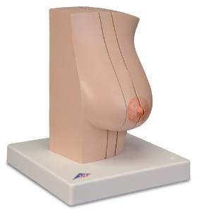 3B Scientific® Model of The Femalebreast