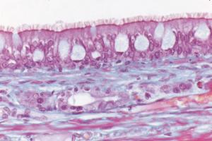 Pseudostratified, Ciliated, Columnar Epithelium, Masson