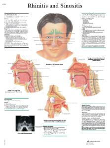 3B Scientific® Rhinitis Chart