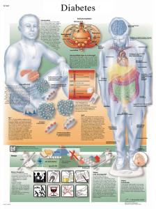 3B Scientific® Diabetes Chart