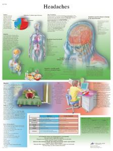 3B Scientific® Headache Chart