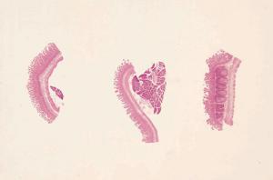 Small Intestine, Composite Slide