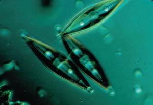 Ward's® Live Diatom cultures