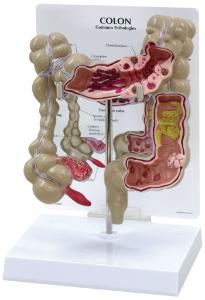 GPI Anatomicals® Colon Model