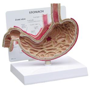 GPI Anatomicals® Basic Stomach Model