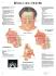 3B Scientific® Rhinitis Chart