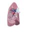 GPI Anatomicals® Basic Lung Model